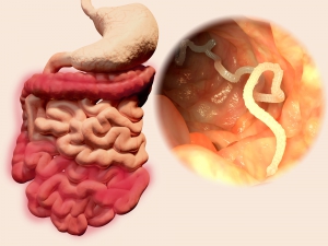 Bandworm im gastrointestinal tract